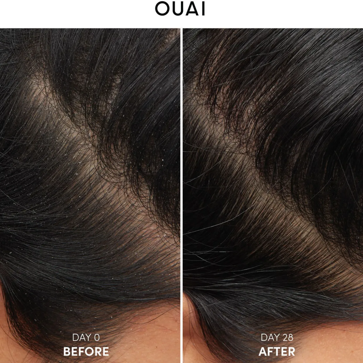 Antidandruff Shampoo