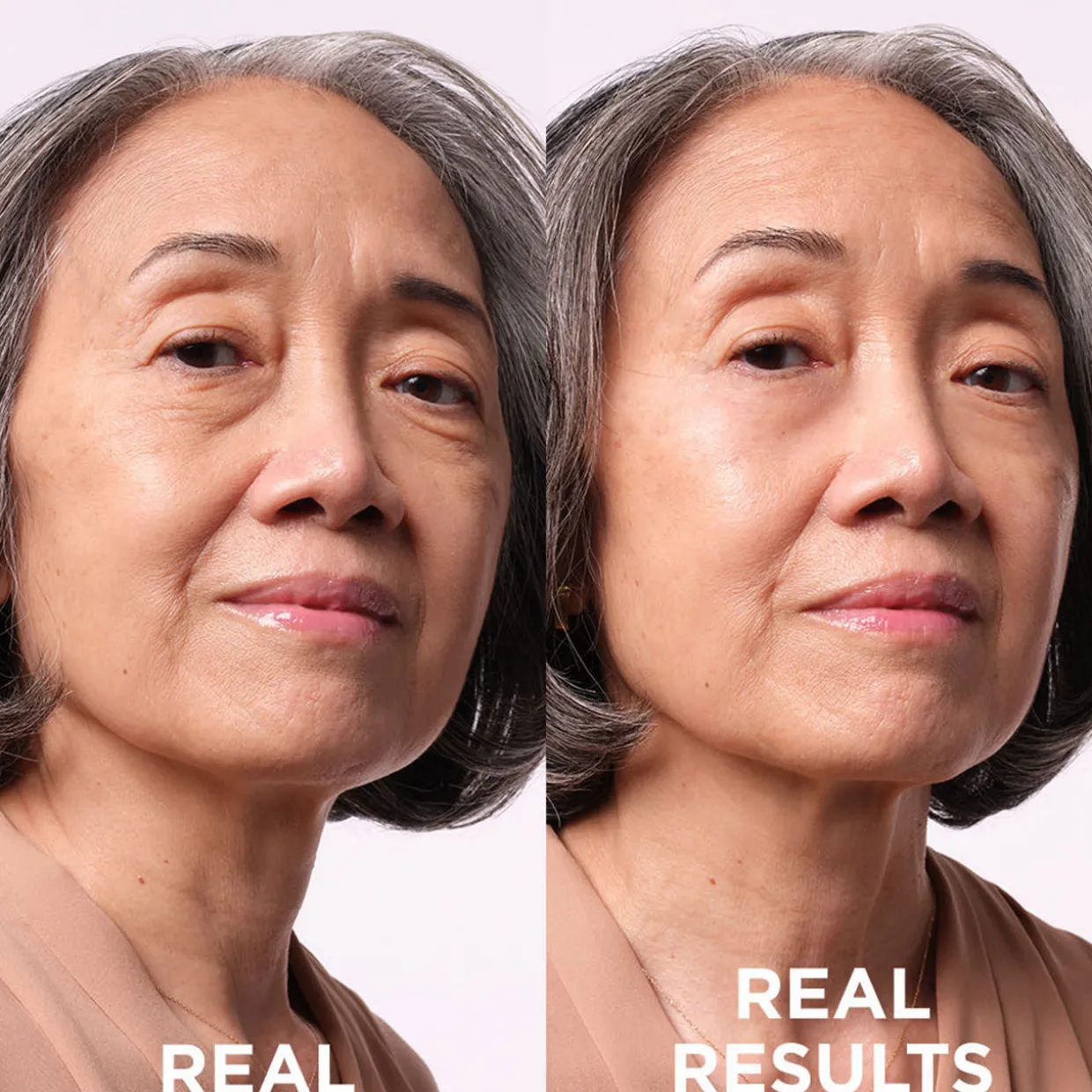 Bye Bye Under Eye Bags Rapid Bag Reducer