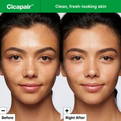 Cicapair™ Gentle Cleansing Foam