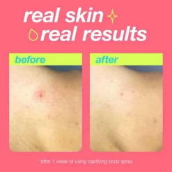 Clarifying Body Spray