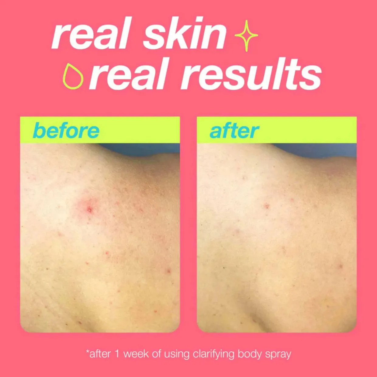 Clarifying Body Spray