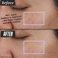 Clearly Corrective™ Clarity-Activating Smoothing Emulsion