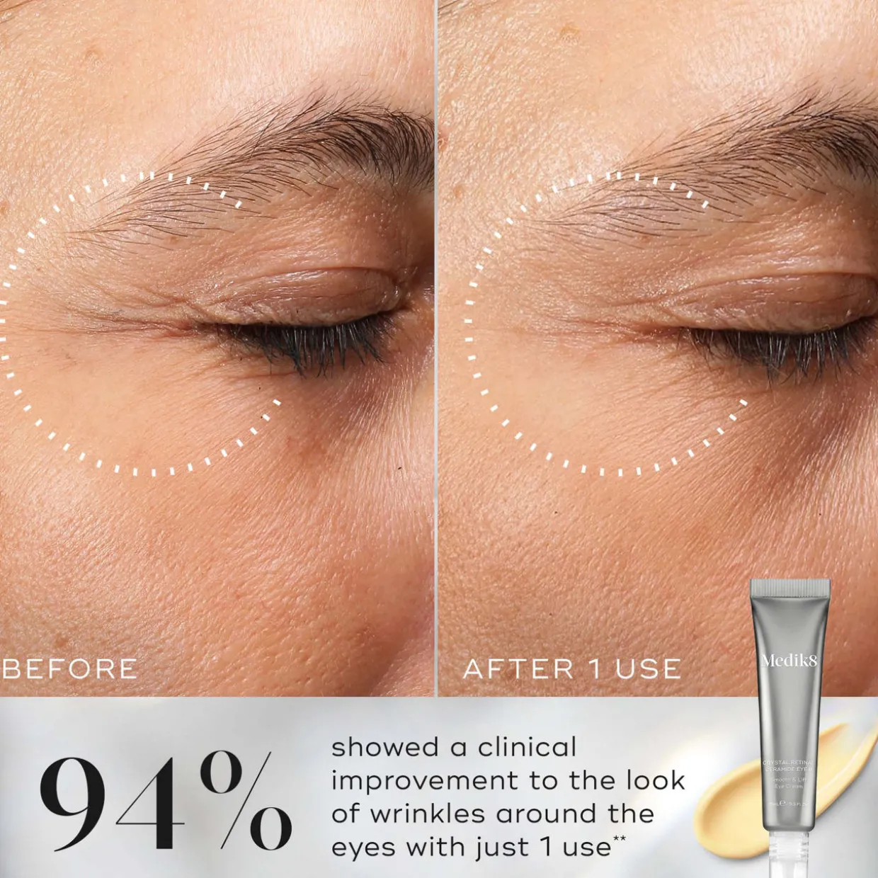 Crystal Retinal Ceramide Eye 6