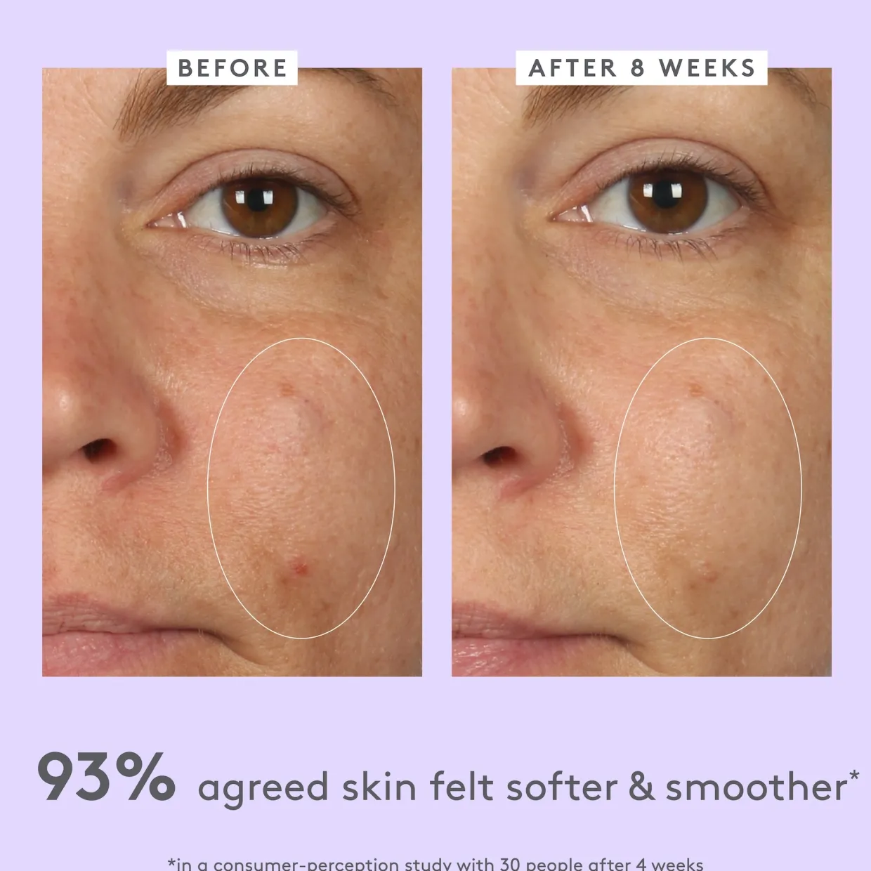 Lala Retro™ Ceramide Face Moisturiser