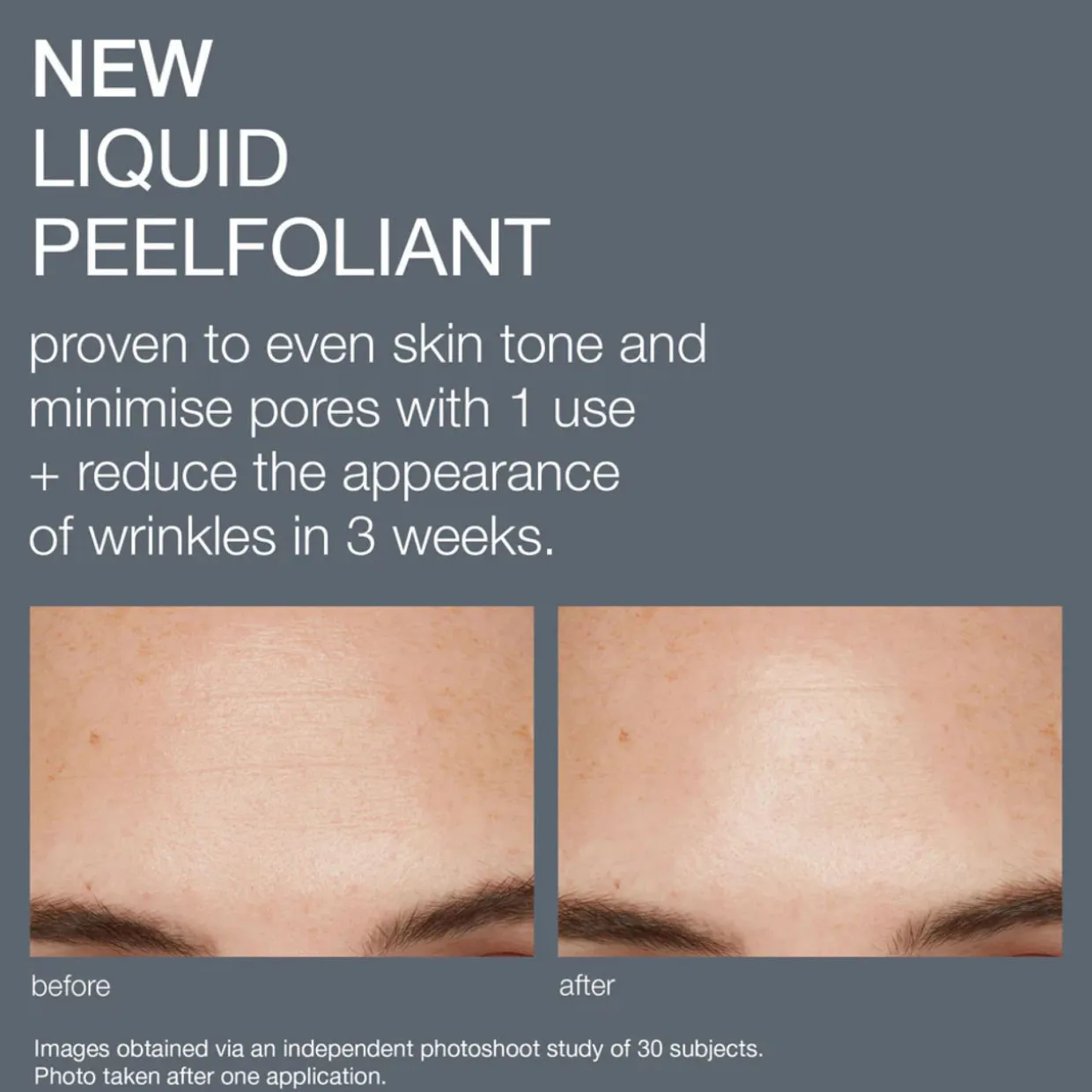 Liquid Peelfoliant