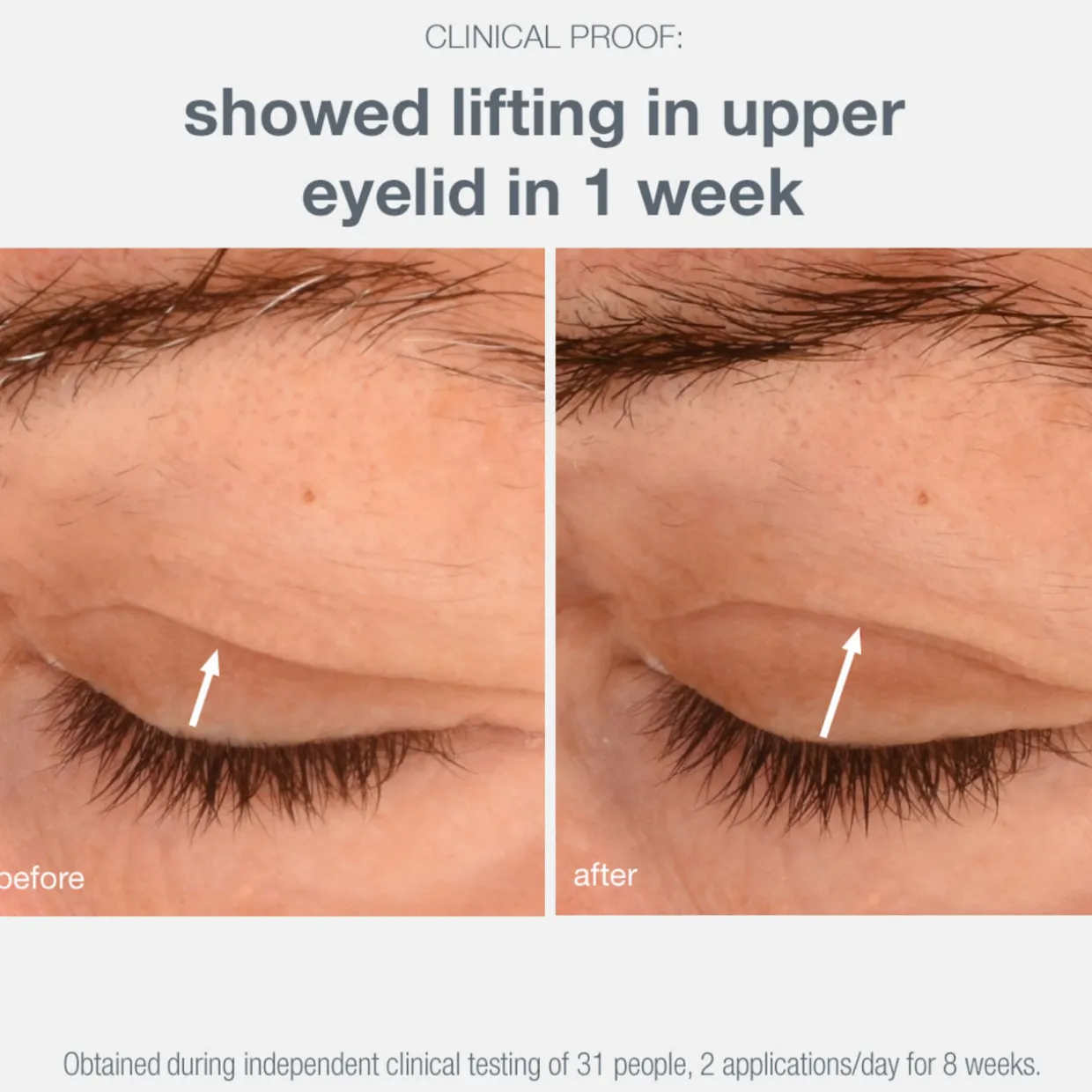 Phyto Nature Eye Lifting Cream
