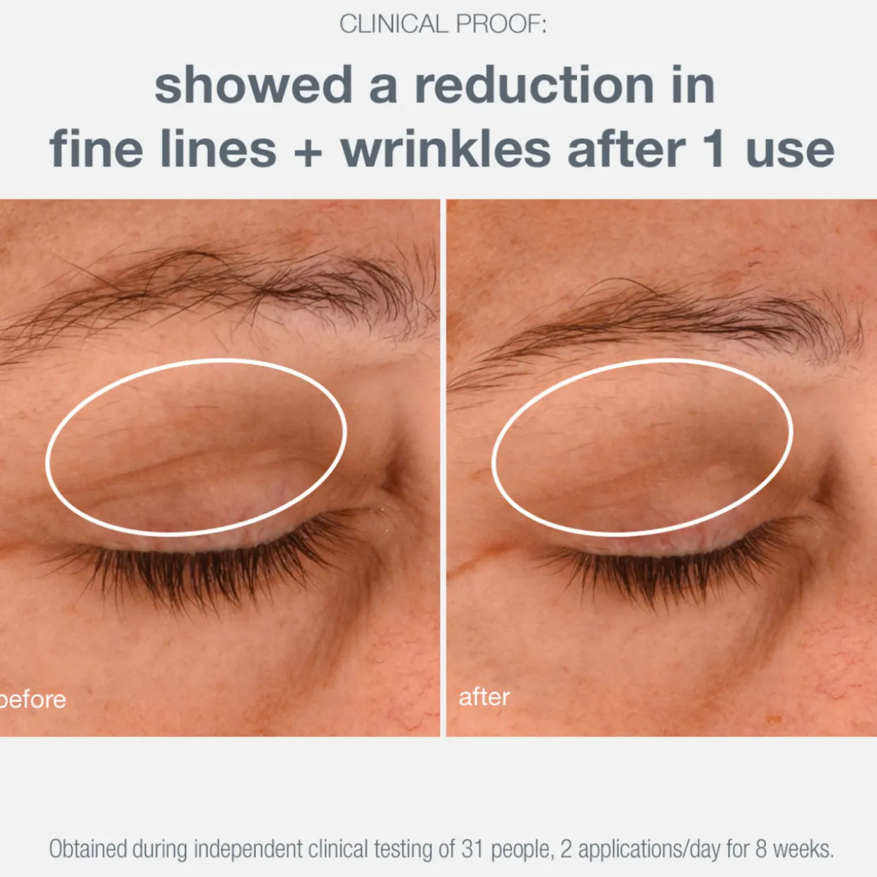 Phyto Nature Eye Lifting Cream