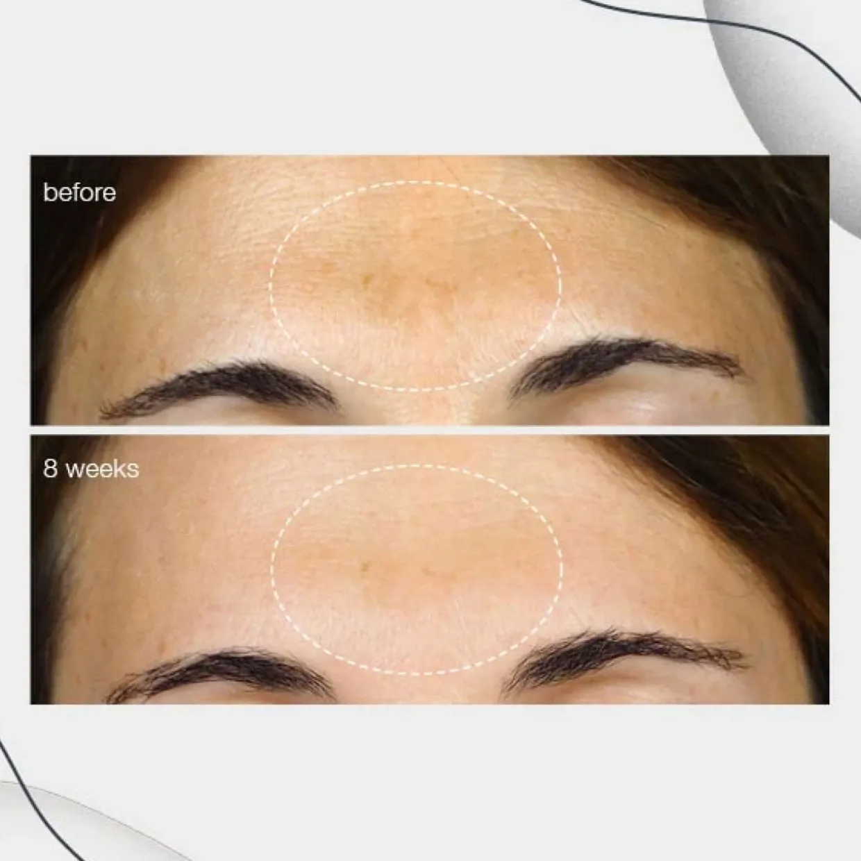 Powerbright Dark Spot Corrector