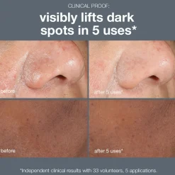 Powerbright Dark Spot Peel