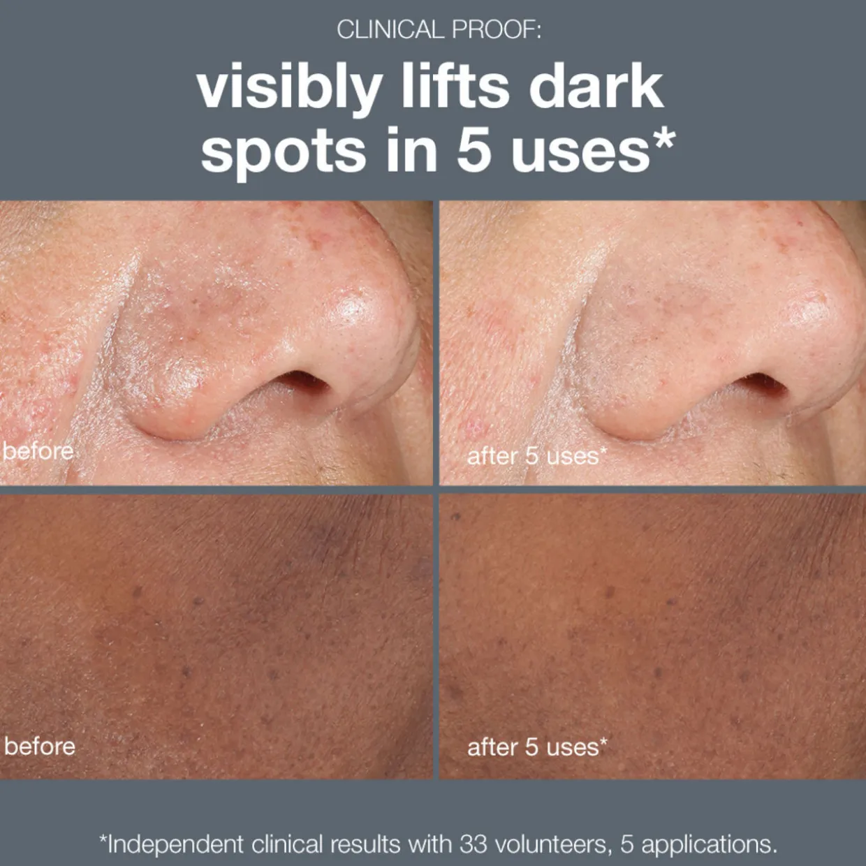 Powerbright Dark Spot Peel