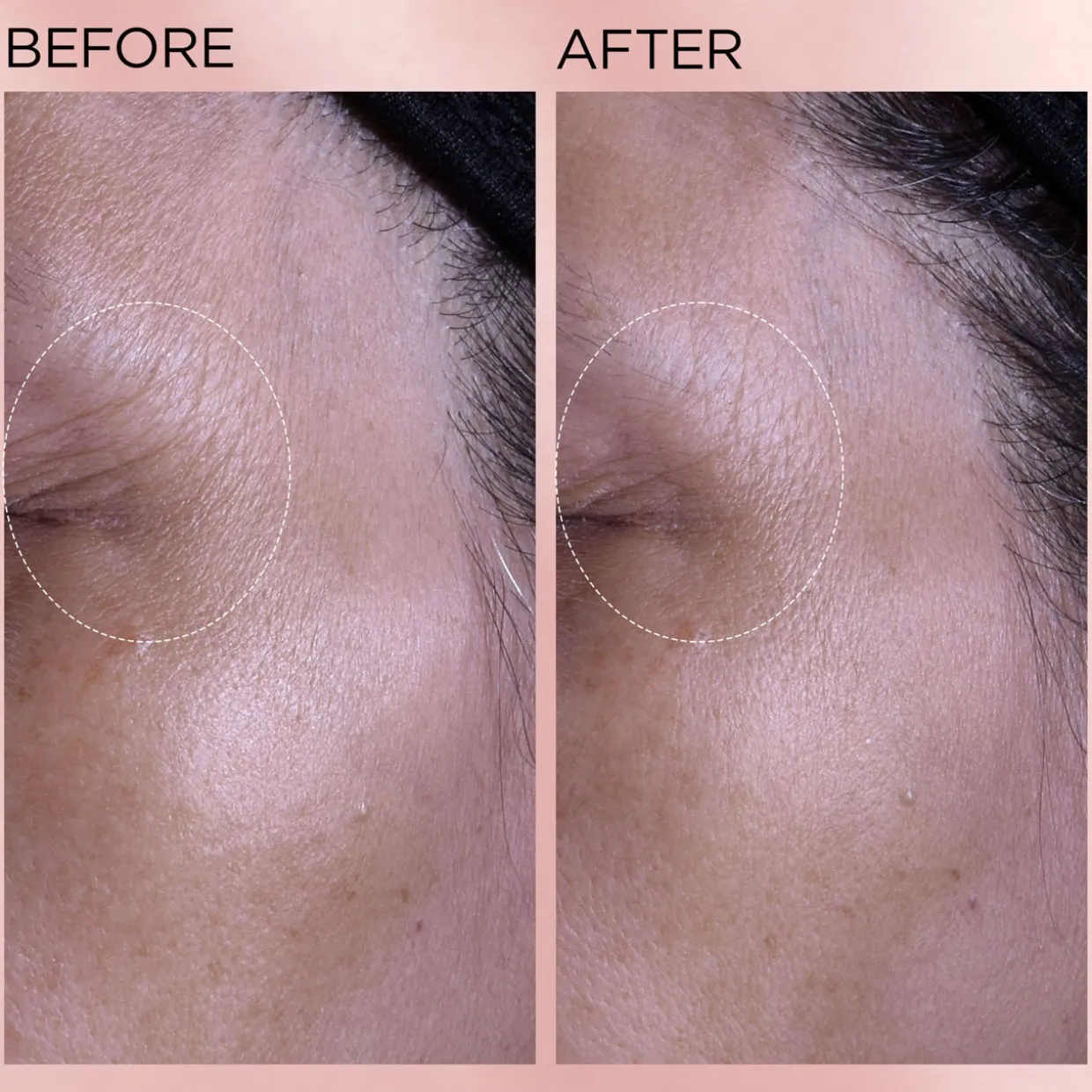 Retinol + HPR Rapid Skin Renewing Water Cream