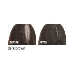 Root Cover Up