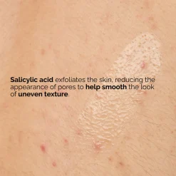 Salicylic Acid 0.5% Body Serum