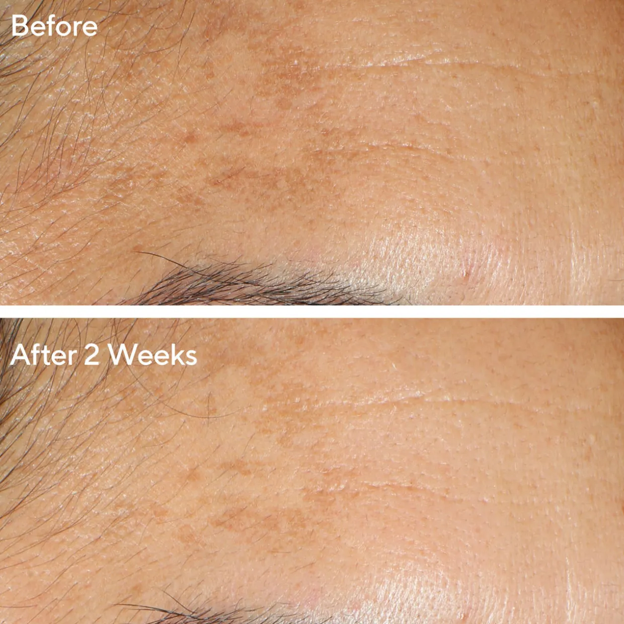 Serum Vita-C Glycolic