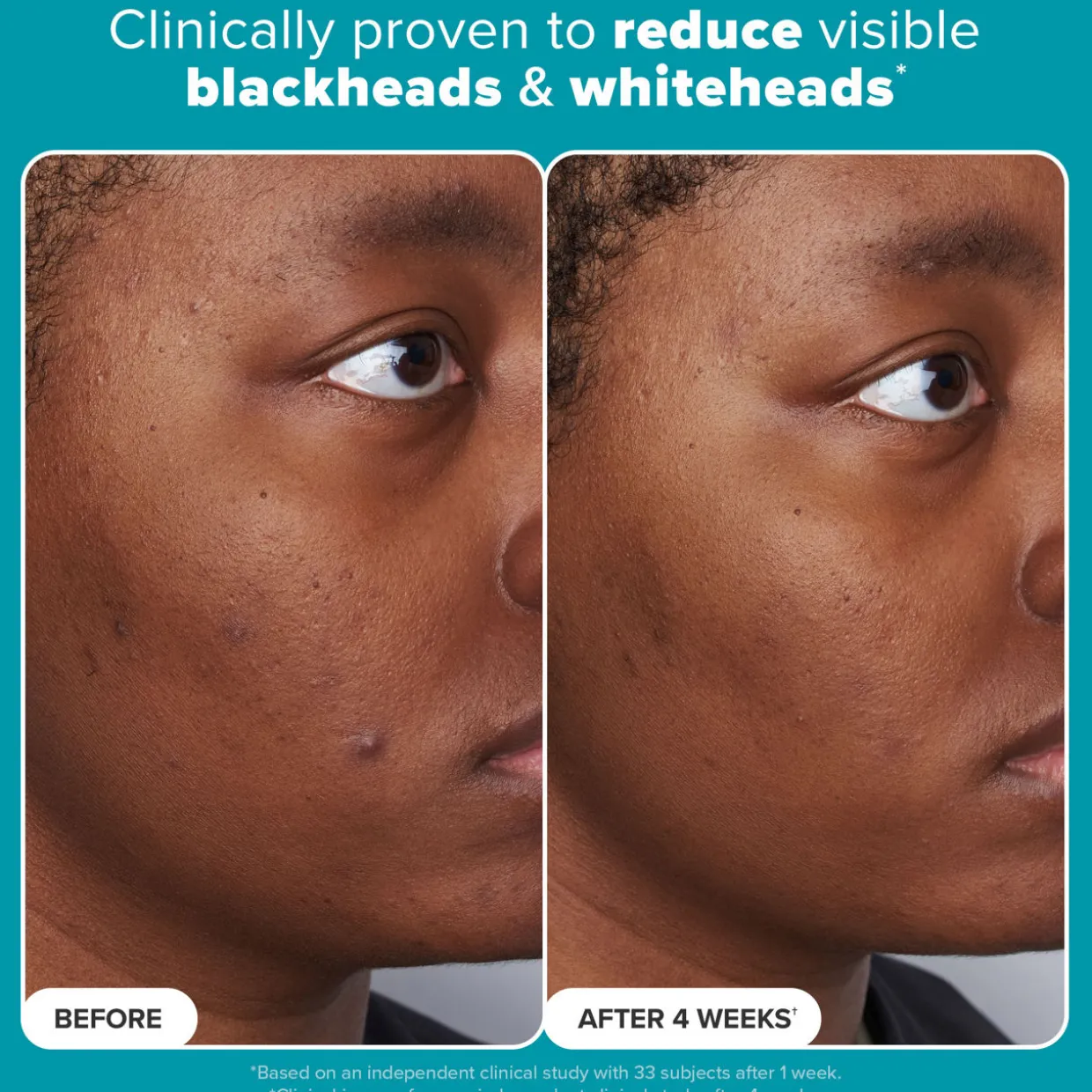 Skin Perfecting 2% BHA Liquid Exfoliant