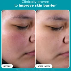 Skin Perfecting 2% BHA Liquid Exfoliant