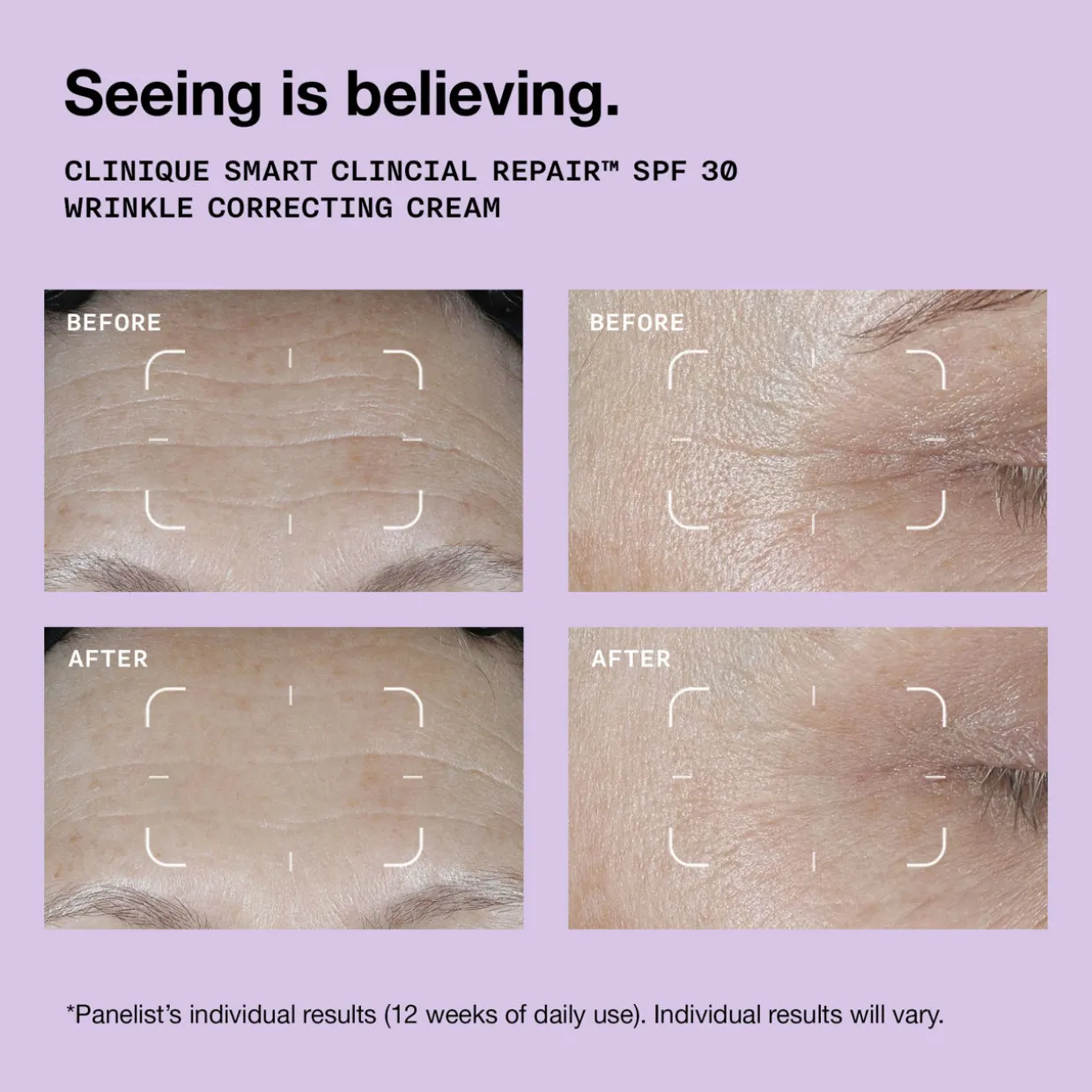 Smart Clinical Repair™ SPF 30 Wrinkle Correcting Cream