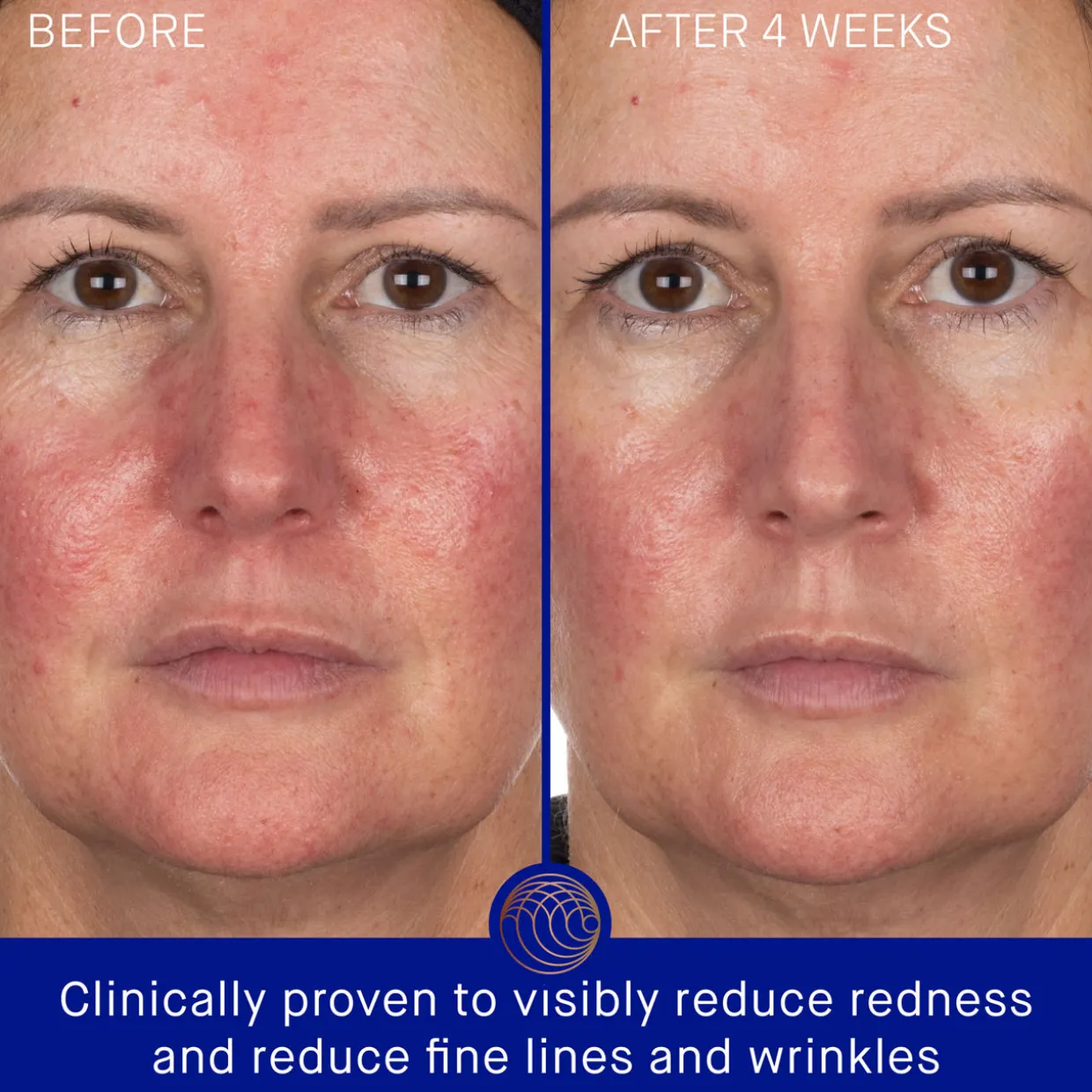 The Hydrogel Face Mask Single Sachet